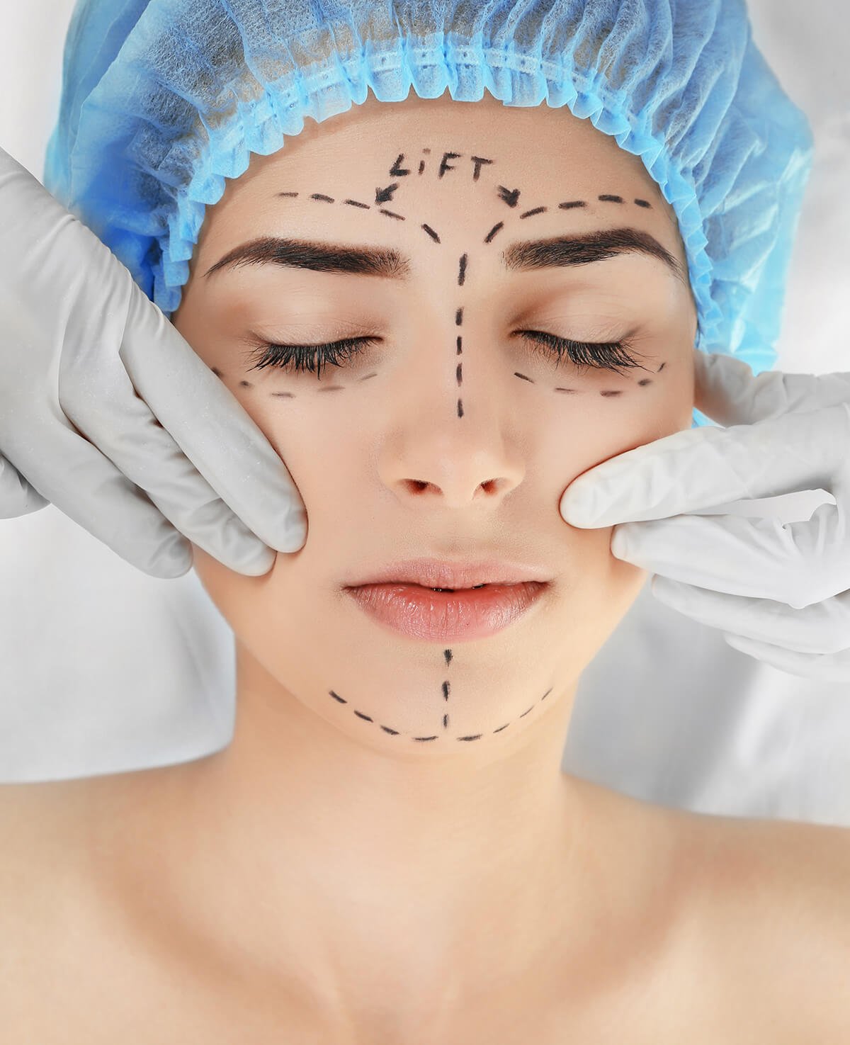 Face & Neck Lifting-Dr-Tamer-Haliloğlu-istanbul-turkey